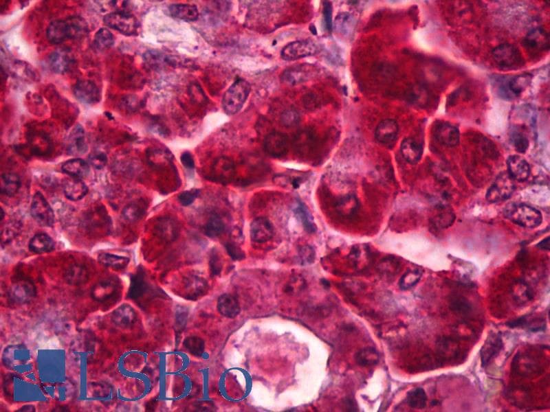 IHC-plus™ Polyclonal Rabbit anti-Human OPG / Osteoprotegerin Antibody (IHC, WB)