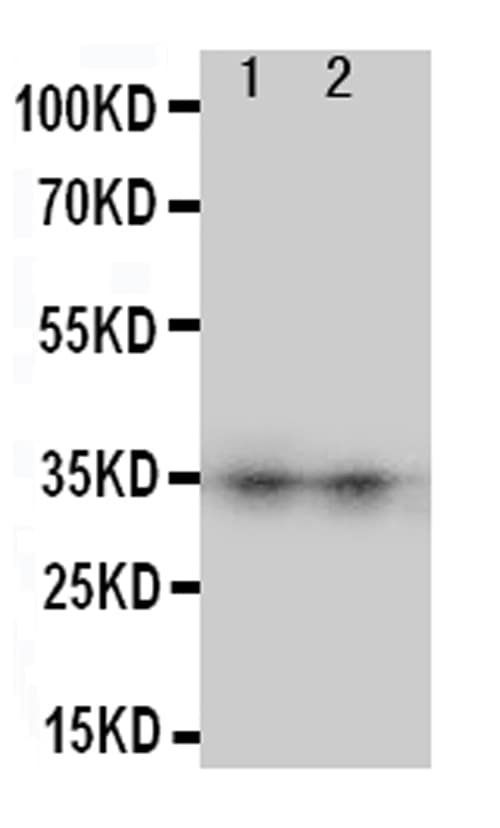 Polyclonal Rabbit anti-Human AQP8 / Aquaporin 8 Antibody (aa1-19, WB)