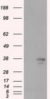 PIM2 / Pim-2 Antibody (clone OTI8G10)