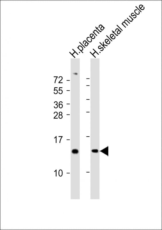 KISS1 / Kisspeptin / Metastin Antibody (aa20-52)