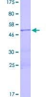 Human LIN28A / LIN28 Protein (Recombinant GST)