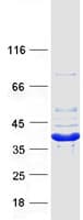 Human CRYM Protein (Recombinant Myc-DDK (Flag))