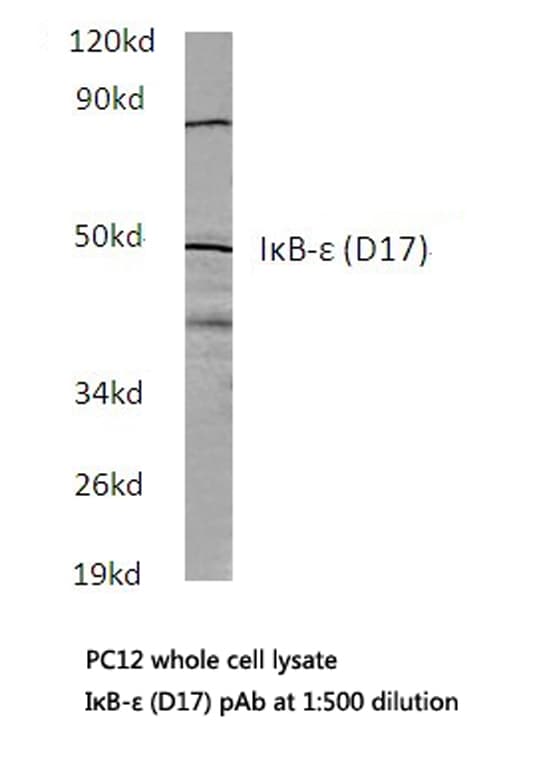 NFKBIE / IKB Epsilon Antibody (Asp17)