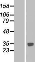 CTDSPL Protein (Over-Expression Lysate Myc-DDK (Flag))