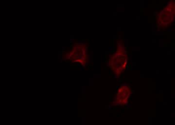 ATXN2 / SCA2 / Ataxin-2 Antibody