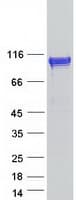 Human RABGAP1L Protein (Recombinant Myc-DDK (Flag))