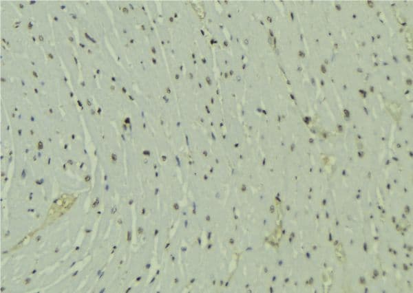 SH2B1 Antibody
