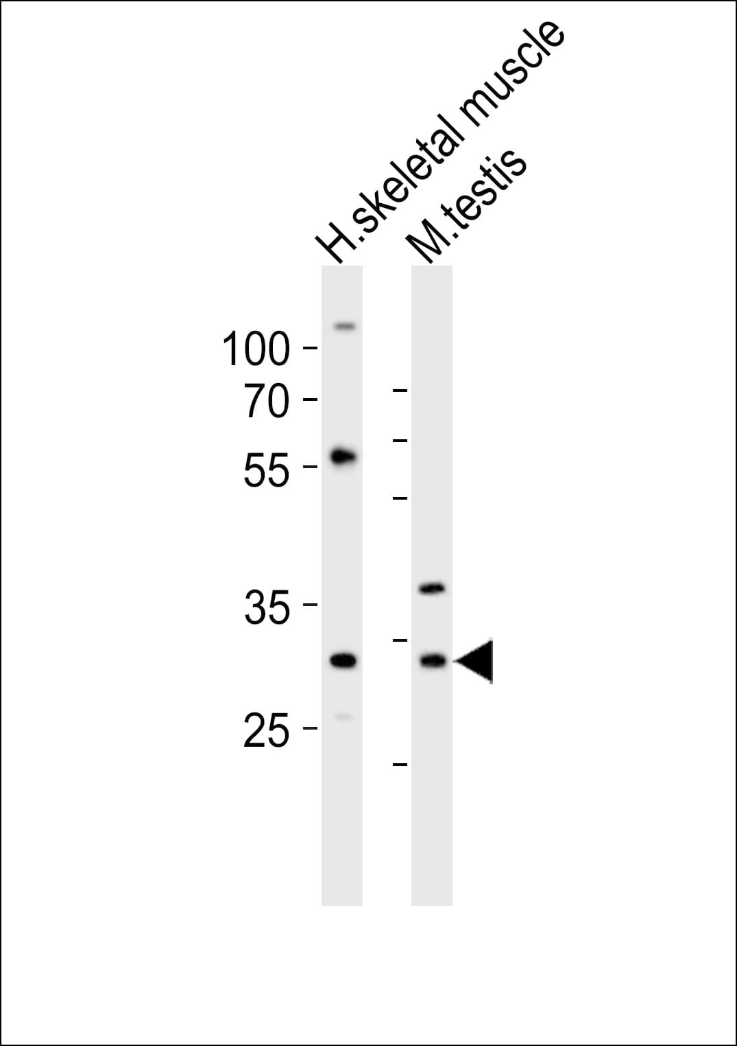 MLF1 Antibody (aa91-126)