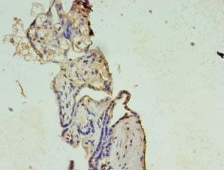 XAGE1E Antibody