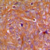 CARD14 Antibody (Internal)