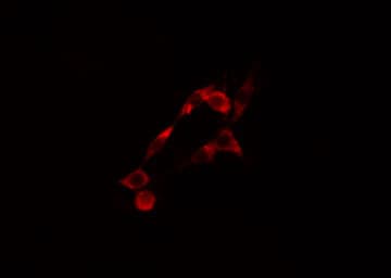 KPI-2 / LMTK2 Antibody