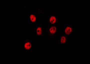 USP44 Antibody