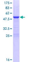 Human PDCD10 Protein (Recombinant GST)