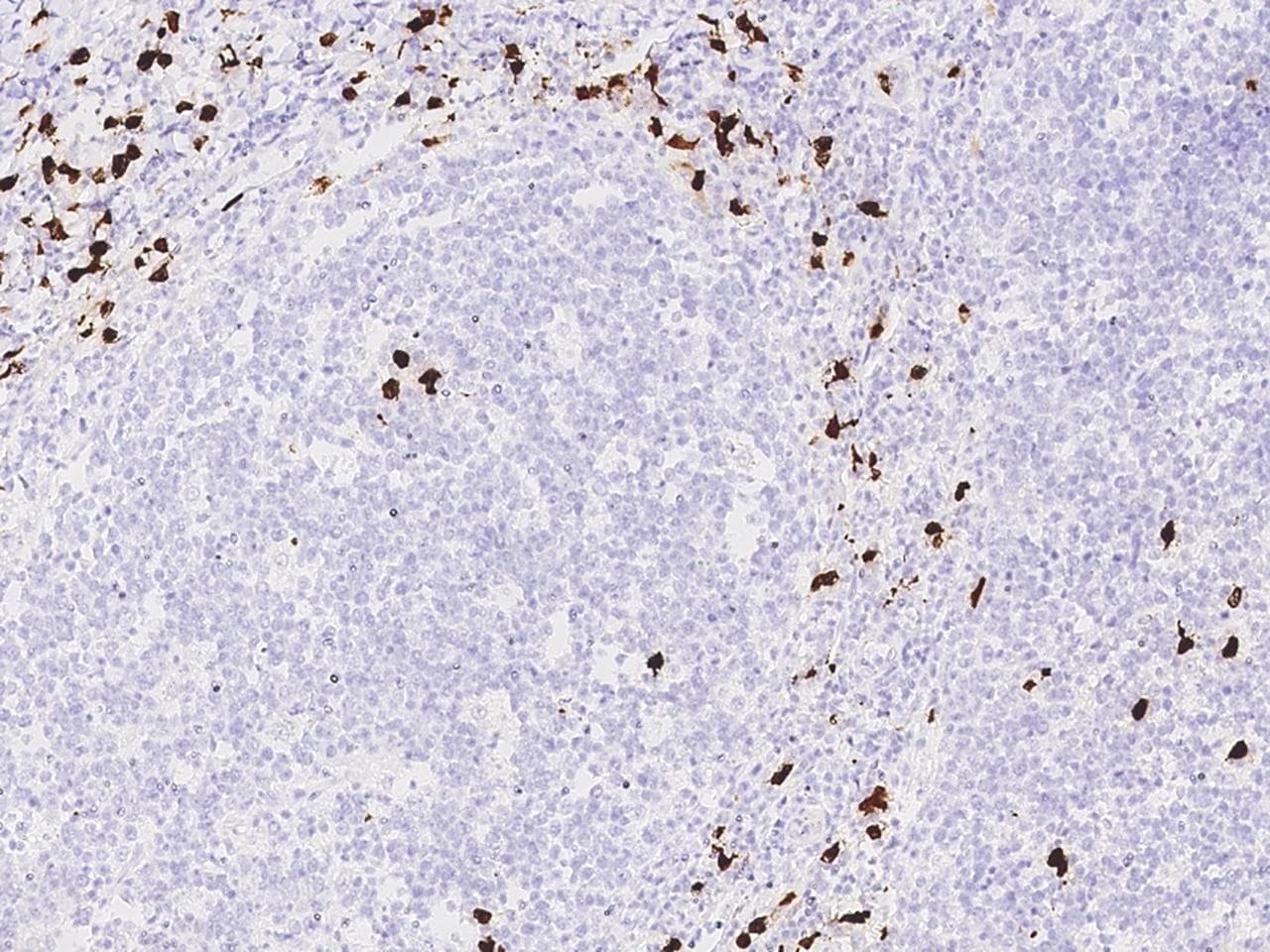 S100A8 / MRP8 Antibody (clone 03, Preservative Free)