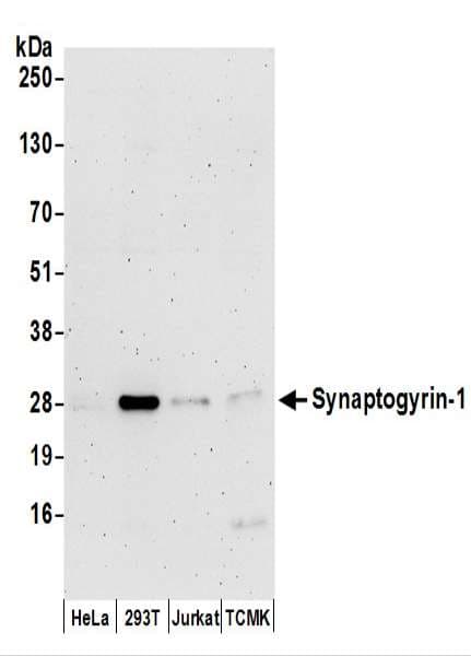 SYNGR1 / Synaptogyrin 1 Antibody (aa183-233)