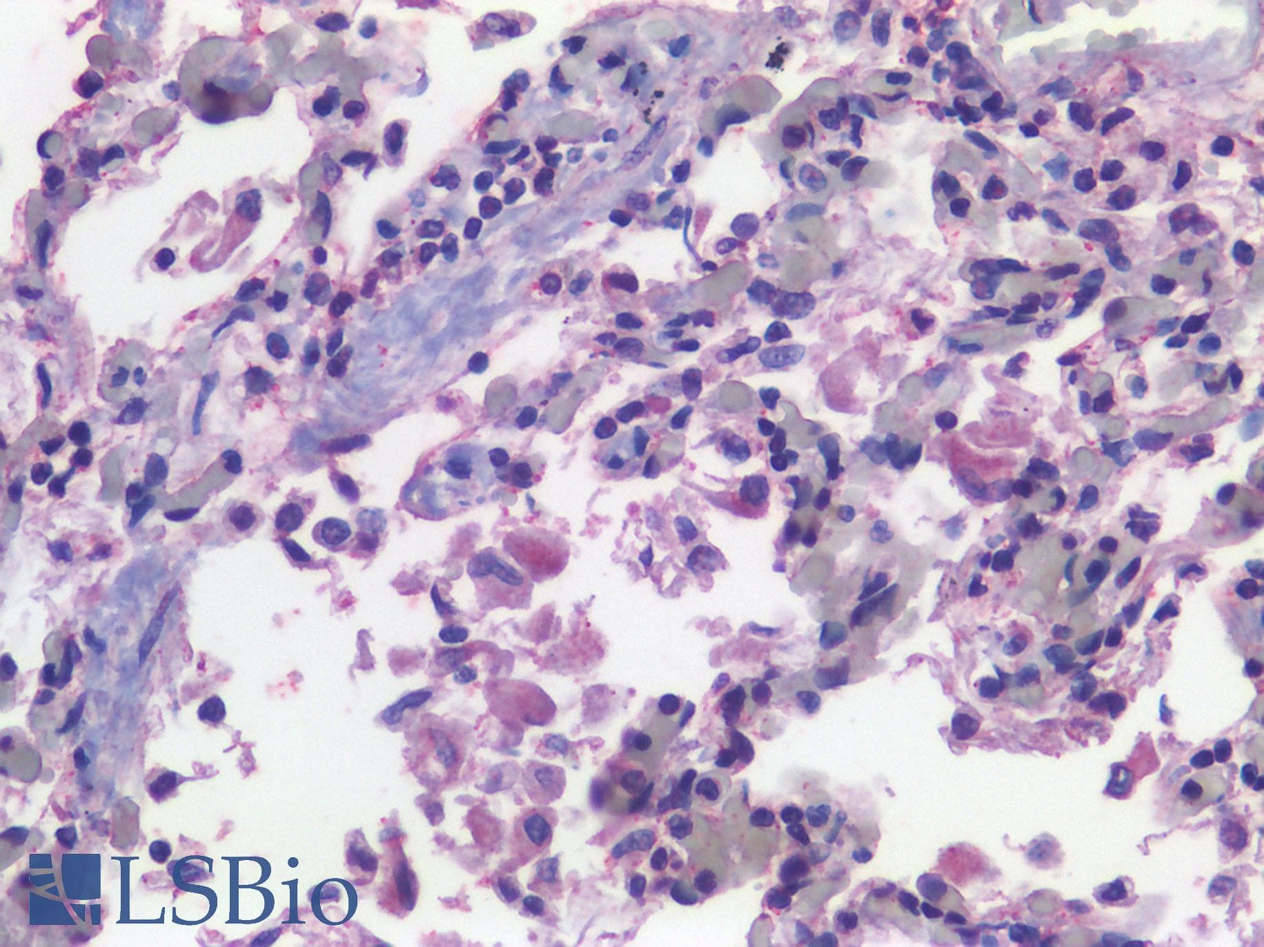 PathPlus™ ITGAX / CD11c Antibody (Internal)