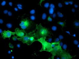 Monoclonal Mouse anti-Human PECAM-1 / CD31 Antibody (clone OTI2F4, IF, WB)