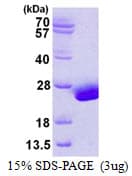 Human UBCH / UBE2H Protein (Recombinant His)