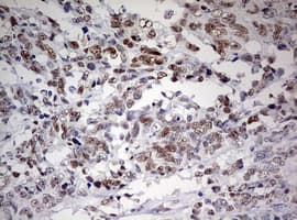 FEN1 Antibody (aa117-380, clone OTI1F3)