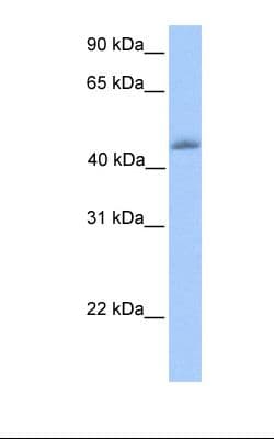 Polyclonal Rabbit anti-Human KLF4 Antibody (aa401-450, IHC, WB)
