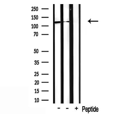 Polyclonal Rabbit anti-Human CDCA2 Antibody (IF, WB)