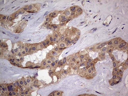 Monoclonal Mouse anti-Human SMPD1 / Acid Sphingomyelinase Antibody (clone OTI3H7, aa62-341, IHC, WB)
