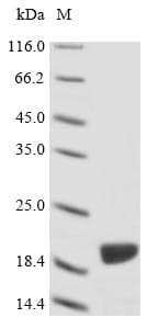 Absidia glauca ACTA1 / Skeletal Muscle Actin Protein (Recombinant 6His, N-terminus + Myc, C-terminus)