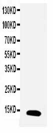TFF1 / pS2 Antibody (aa67-84)