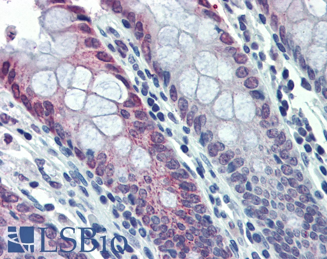 IHC-plus™ HDAC2 Antibody (N-Terminus)