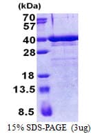 Human ZNF346 Protein (Recombinant His)