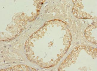 PPP3R2 Antibody