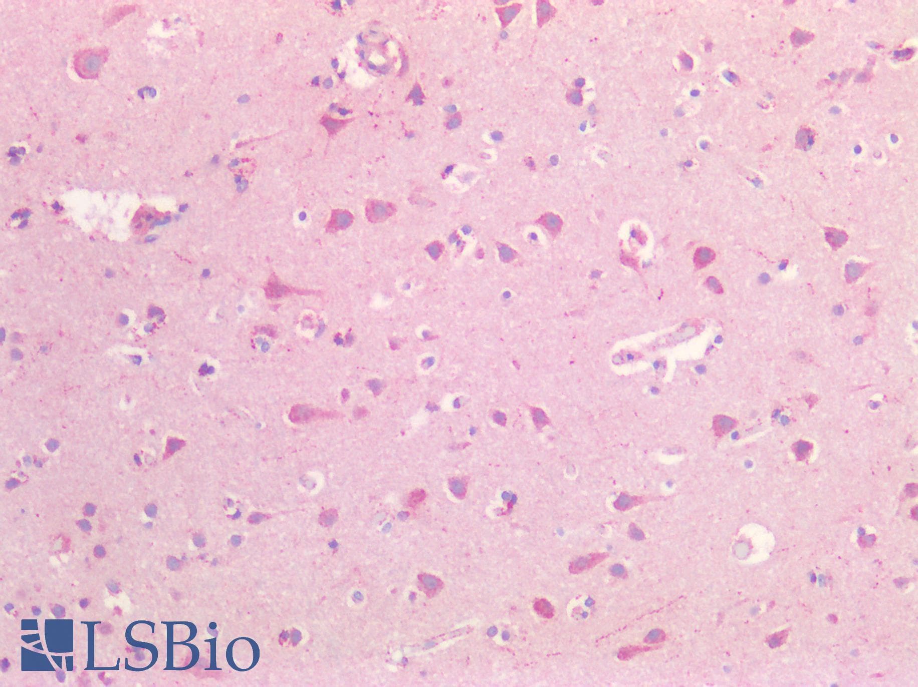 IHC-plus™ HFE Antibody