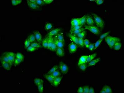 Polyclonal Rabbit anti-Human HSPA5 / GRP78 / BiP Antibody (IHC, WB)