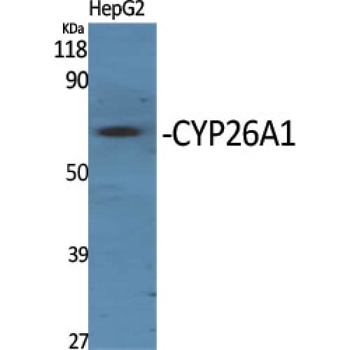 CYP26 / CYP26A1 Antibody (220-300 aa, Internal)