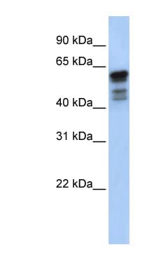 DES / Desmin Antibody (aa396-445)