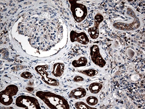 CTSL / Cathepsin L Antibody (aa114-333, clone OTI2C10)