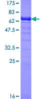 Human TBCC Protein (Recombinant GST)