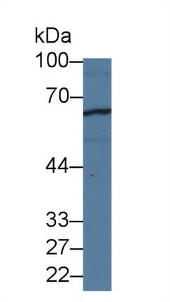 C1qRP / CD93 Antibody (aa227-493)