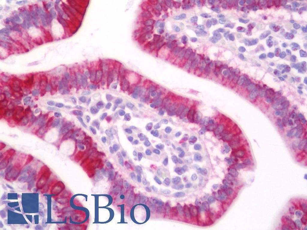 IHC-plus™ Polyclonal Rabbit anti-Human CBR / CBR1 Antibody (aa181-230, IHC, WB)