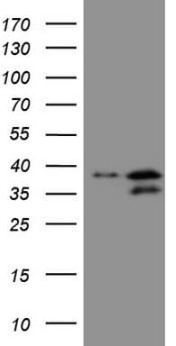 POU2AF1 / BOB1 Antibody (clone OTI13G1)