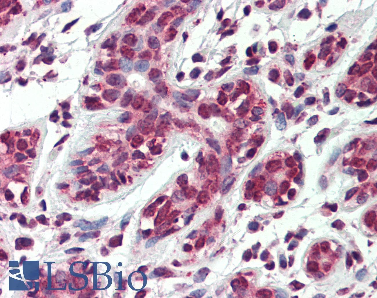 IHC-plus™ ARL2 Antibody
