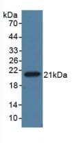 AMH / Anti-Mullerian Hormone Antibody