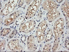 RARRES1 Antibody (clone OTI1H2)
