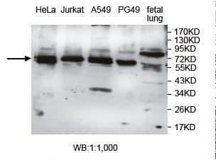AGBL4 Antibody (aa109-268)