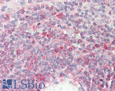 IHC-plus™ Monoclonal Mouse anti-Human RACGAP1 / MGCRACGAP Antibody (clone 1G6, IHC, WB)