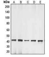 Polyclonal Rabbit anti-Human ACTG1 / Gamma Actin Antibody (C-Terminus, IHC, WB)