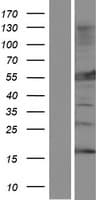 Human MLYCD / MCD Protein (Over-Expression Lysate Myc-DDK (Flag))