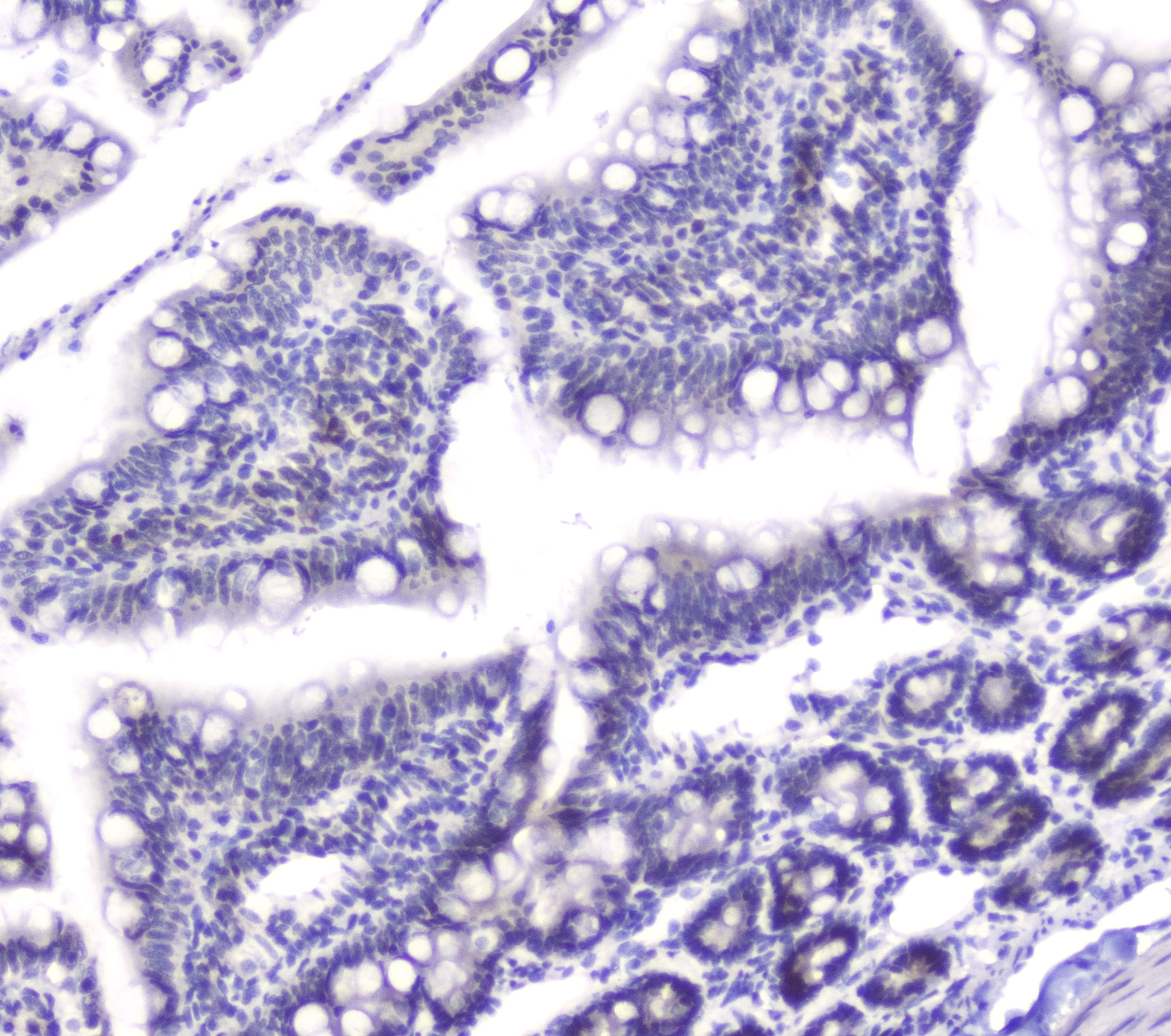 DCK / Deoxycytidine kinase Antibody