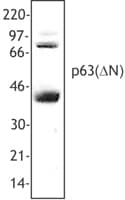 TP63 / p63 Antibody