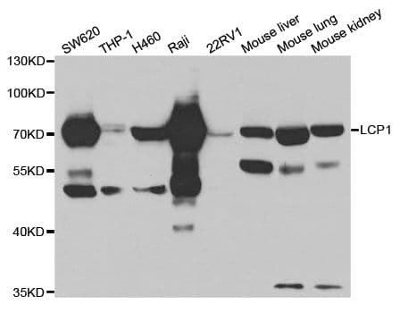 LCP1 / L-Plastin Antibody
